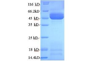SDS-PAGE (SDS) image for Hydroxysteroid (11-Beta) Dehydrogenase 2 (HSD11B2) (AA 1-405), (full length) protein (His tag) (ABIN5713514)