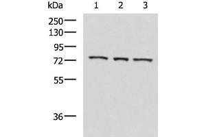 Western blot analysis of K562 cell Mouse heart tissue Jurkat cell lysates using ABI2 Polyclonal Antibody at dilution of 1:550 (ABI2 Antikörper)