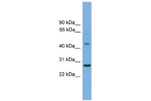 WB Suggested Anti-ZNF514 Antibody Titration:  0. (ZNF514 Antikörper  (Middle Region))