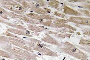Immunohistochemistry analysisof BMP-2 Antibody in paraffin-embedded human heart tissue. (BMP2 Antikörper)