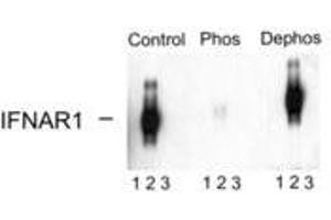 Image no. 1 for anti-Interferon alpha/beta Receptor 1 (IFNAR1) (pSer535), (Ser539) antibody (ABIN228236) (IFNAR1 Antikörper  (pSer535, Ser539))