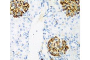 Immunohistochemistry of paraffin-embedded Rat kidney using CSRNP1 Polyclonal Antibody at dilution of 1:200 (40x lens). (AXUD1 Antikörper)