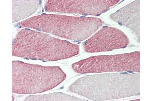 Human Skeletal Muscle: Formalin-Fixed, Paraffin-Embedded (FFPE) (CYP2D6 Antikörper  (AA 268-457))