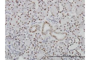 Immunoperoxidase of monoclonal antibody to PBX1 on formalin-fixed paraffin-embedded human salivary gland. (PBX1 Antikörper  (AA 213-321))