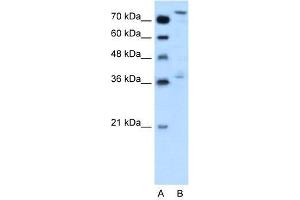 Human HepG2; WB Suggested Anti-NFE2L3 Antibody Titration: 0. (NFE2L3 Antikörper  (Middle Region))