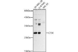 Western blot analysis of extracts of various cell lines, using CTSK antibody (ABIN3022538, ABIN3022539, ABIN3022540 and ABIN6218889) at 1:500 dilution. (Cathepsin K Antikörper  (AA 115-329))