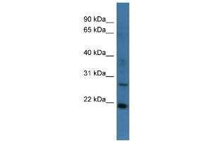 WB Suggested Anti-STARD4 Antibody Titration: 0. (STARD4 Antikörper  (Middle Region))
