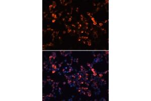 Immunofluorescence analysis of 293T cells using Mouse anti GFP-Tag mAb. (GFP Antikörper  (AA 1-100))