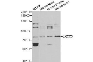 Western blot analysis of extracts of various cell lines, using ERCC3 antibody. (ERCC3 Antikörper)