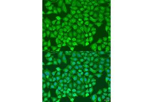 Immunofluorescence (IF) image for anti-CCCTC-Binding Factor (Zinc Finger Protein) (CTCF) (AA 1-260) antibody (ABIN3021507)