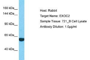 Host: Rabbit Target Name: EXOC2 Sample Type: 721_B Whole Cell lysates Antibody Dilution: 1.