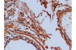 Detection of OCT4 in Human Mammary gland Tissue using Polyclonal Antibody to Octamer Binding Transcription Factor 4 (OCT4) (OCT4 Antikörper  (AA 136-360))