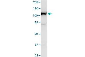 CAND1 polyclonal antibody (A01), Lot # 051005JC01. (CAND1 Antikörper  (AA 1-100))