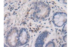 Immunohistochemistry (IHC) image for anti-Transforming Growth Factor, beta 2 (TGFB2) (AA 303-414) antibody (ABIN7429457)