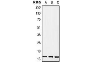 Western blot analysis of MGST2 expression in MCF7 (A), SP2/0 (B), PC12 (C) whole cell lysates.