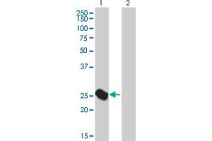 Western Blotting (WB) image for ARG1 293T Cell Transient Overexpression Lysate(Denatured) (ABIN1339776)
