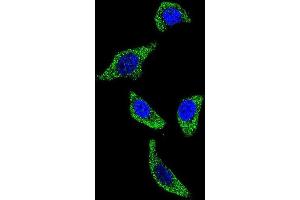 Confocal immunofluorescent analysis of TNFRSF1A Antibody (N-term) with U-251MG cell followed by Alexa Fluor 488-conjugated goat anti-rabbit lgG (green).