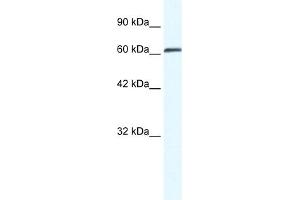 WB Suggested Anti-ZNF258 Antibody Titration:  0. (ZMYM6 Antikörper  (Middle Region))