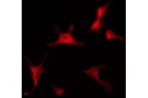 ABIN6267477 staining SW626 by IF/ICC.