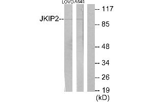 Immunohistochemistry analysis of paraffin-embedded human brain tissue using JKIP2 antibody. (JAKMIP2 Antikörper)