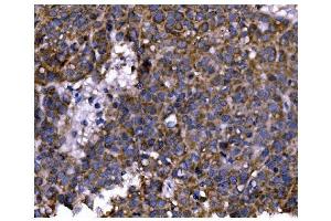 IHC analysis of PFKFB2 using anti-PFKFB2 antibody (ABIN7601627). (PFKFB2 Antikörper  (AA 4-505))