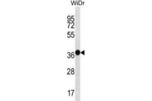 Western blot analysis in WiDr cell line lysates (35ug/lane) using Mucin-15 Antibody (C-term). (MUC15 Antikörper  (C-Term))