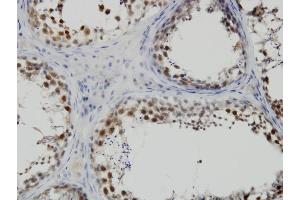 Immunoperoxidase of monoclonal antibody to PBK on formalin-fixed paraffin-embedded human testis. (PBK Antikörper  (AA 1-110))