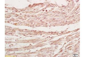 Formalin-fixed and paraffin embedded mouse embryo labeled with Rabbit Anti MYPN Polyclonal Antibody, Unconjugated (ABIN1714212) at 1:200 followed by conjugation to the secondary antibody and DAB staining