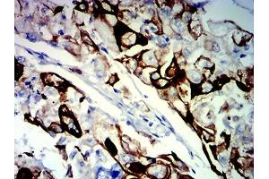 Immunohistochemistry (IHC) image for anti-Keratin 13 (KRT13) (AA 104-458) antibody (ABIN7193705)