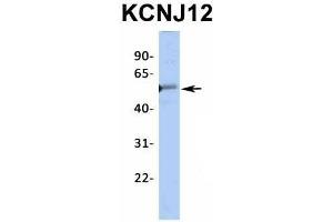 Host:  Rabbit  Target Name:  KCNJ12  Sample Type:  Human Fetal Heart  Antibody Dilution:  1. (Kir2.2 Antikörper  (Middle Region))