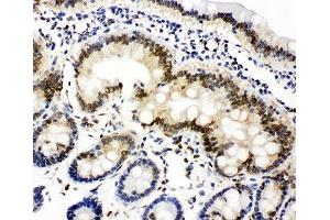 Immunohistochemistry (IHC) image for anti-Lamin A/C (LMNA) (AA 455-469) antibody (ABIN3031585)