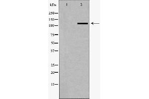 Western blot analysis of A549 whole cell lysates, using SLC4A4 Antibody.
