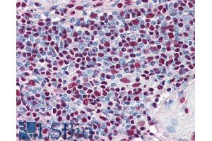 ABIN185611 (5µg/ml) staining of paraffin embedded Human Spleen. (XRCC5 Antikörper  (Internal Region))