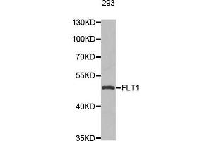 Western blot analysis of extracts of 293 cell line, using FLT1 antibody. (FLT1 Antikörper  (AA 1100-1200))