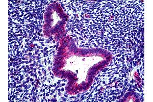 Anti-CLCN2 antibody IHC of human uterus.