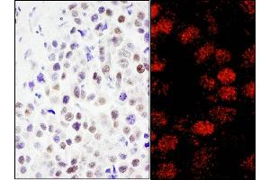 Immunohistochemistry (IHC) image for anti-REST Corepressor 3 (RCOR3) (AA 445-495) antibody (ABIN7455241)