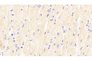 Detection of SIRT2 in Mouse Cardiac Muscle Tissue using Polyclonal Antibody to Sirtuin 2 (SIRT2) (SIRT2 Antikörper  (AA 65-340))