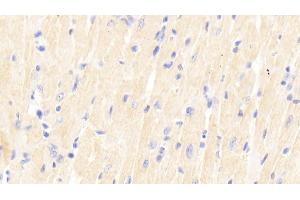 Detection of SIRT2 in Mouse Cardiac Muscle Tissue using Polyclonal Antibody to Sirtuin 2 (SIRT2)