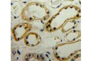 Used in DAB staining on fromalin fixed paraffin-embedded Kidney tissue (LIMS1 Antikörper  (AA 68-303))
