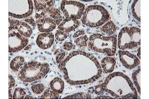 Image no. 11 for anti-Ribophorin 1 (RPN1) antibody (ABIN1500748)