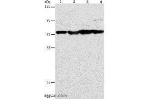 Western blot analysis of Mouse stomach, heart and liver tissue, HT-29 cell, using MMP15 Polyclonal Antibody at dilution of 1:200 (MMP15 Antikörper)