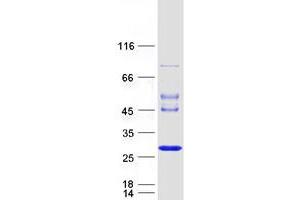 Western Blotting (WB) image for Josephin Domain Containing 1 (JOSD1) protein (Myc-DYKDDDDK Tag) (ABIN2723942)