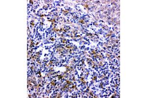 Anti- CXCR6 antibody,  IHC(P) IHC(P): Rat Spleen Tissue (CXCR6 Antikörper  (C-Term))