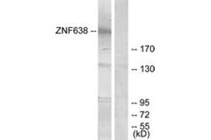 Western blot analysis of extracts from HepG2 cells, treated with serum 20% 15', using ZNF638 Antibody. (ZNF638 Antikörper  (AA 1271-1320))