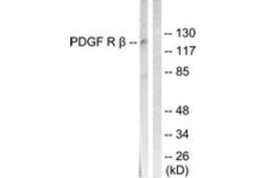 Western blot analysis of extracts from LOVO cells, treated with H2O2 100uM 30', using PDGFR beta (Ab-1021) Antibody. (PDGFRB Antikörper  (AA 991-1040))
