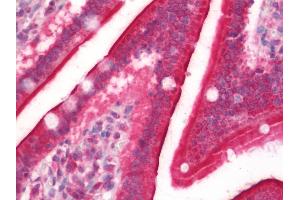 Immunohistochemistry (IHC) image for anti-Hydroxyprostaglandin Dehydrogenase 15-(NAD) (HPGD) (AA 205-266) antibody (ABIN2613503)