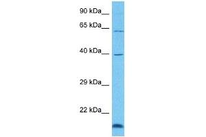 Host:  Rabbit  Target Name:  GRHL3  Sample Tissue:  Human 786-0 Whole Cell  Antibody Dilution:  1ug/ml (GRHL3 Antikörper  (C-Term))
