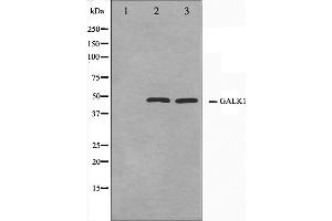Western blot analysis on NIH-3T3 and HeLa cell lysate using GALK1 Antibody,The lane on the left is treated with the antigen-specific peptide. (GALK1 Antikörper  (C-Term))