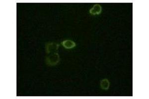 Immunofluorescence staining of methanol-fixed Hela cells using ABL2 mouse mAb showing cytoplasm localization. (ABL2 Antikörper)