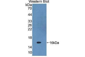 Western blot analysis of the recombinant protein. (PKIG Antikörper  (AA 1-76))